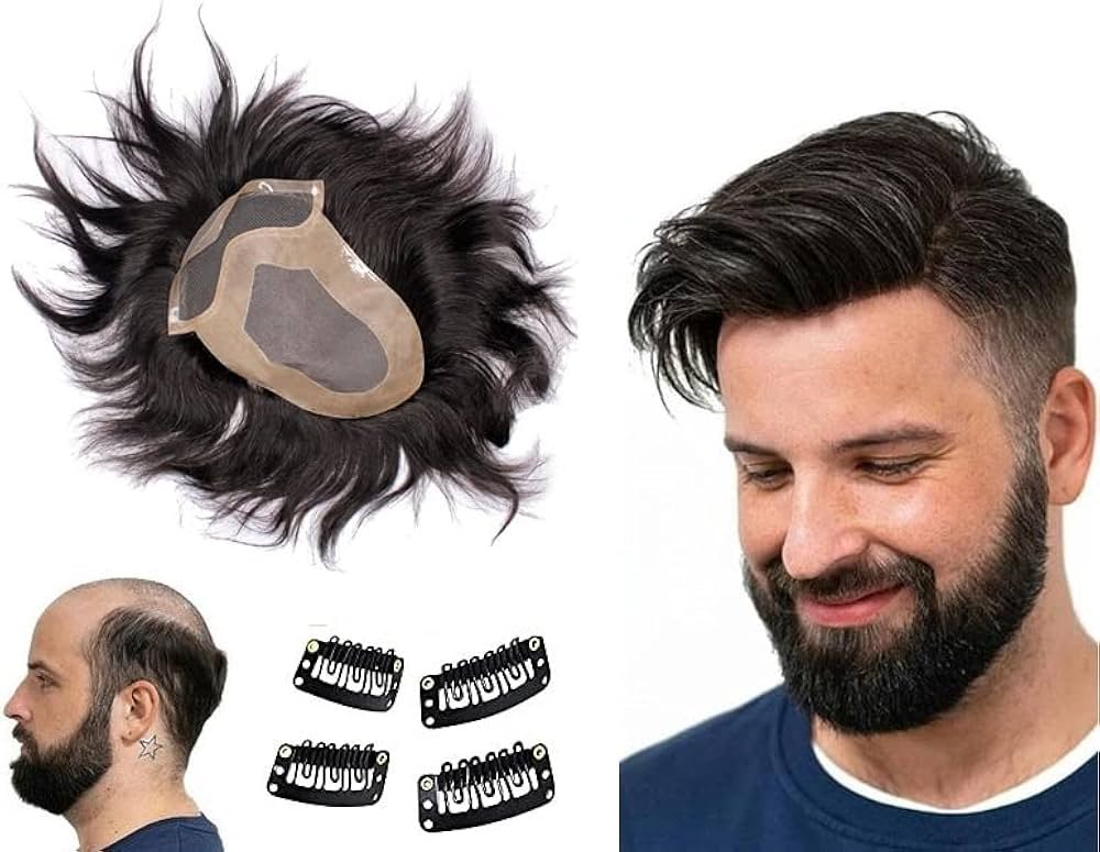 Best Hair Patch in Lajpat Nagar