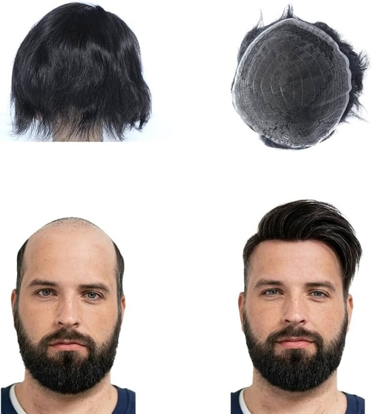 Hair Patch in Lajpat Nagar