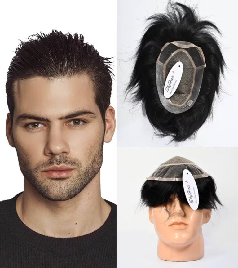 Best Hair Patch Services in Lajpat Nagar