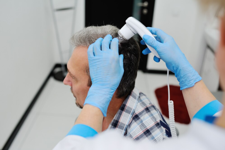 Best Hair patch treatment in South Delhi